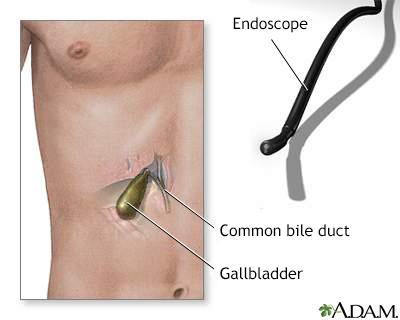 Gallbladder endoscopy